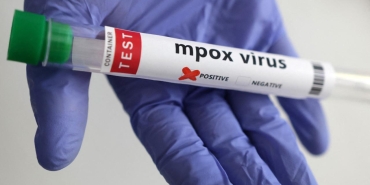 mpox-maymun-cicegi-reu-2270739