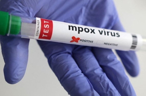 mpox-maymun-cicegi-reu-2270739